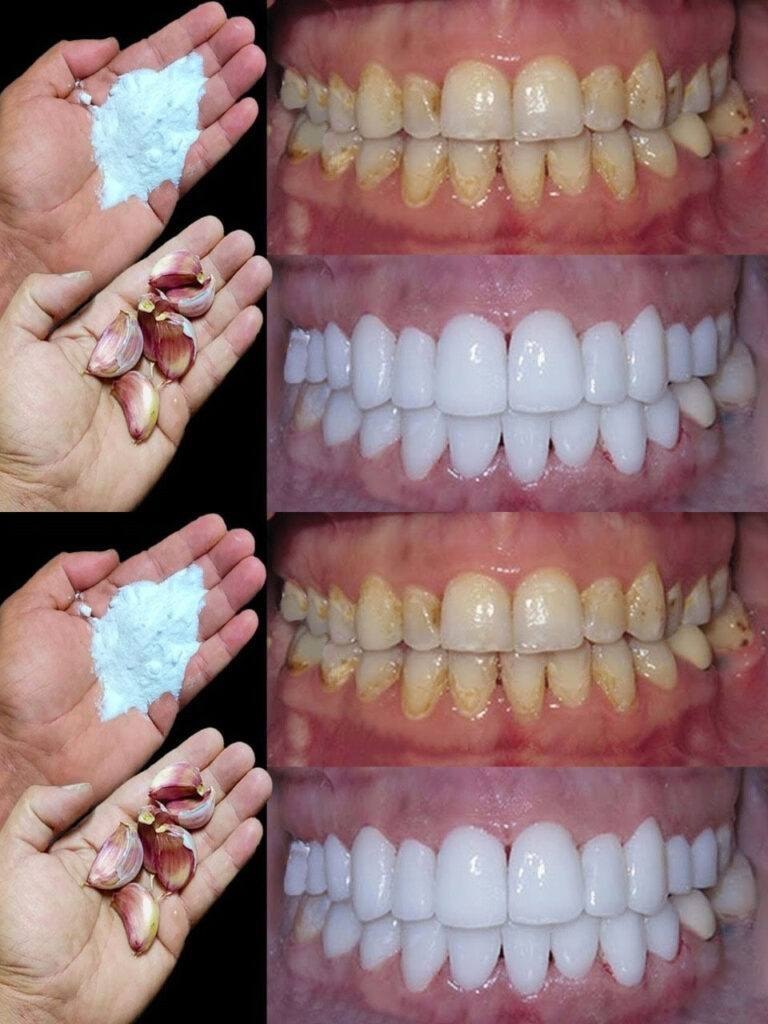 Comment blanchir ses dents en 2 minutes ?