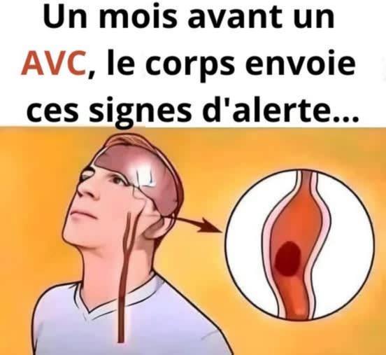 Un mois avant un AVC,, votre corps vous envoie ces signaux d’alarme.