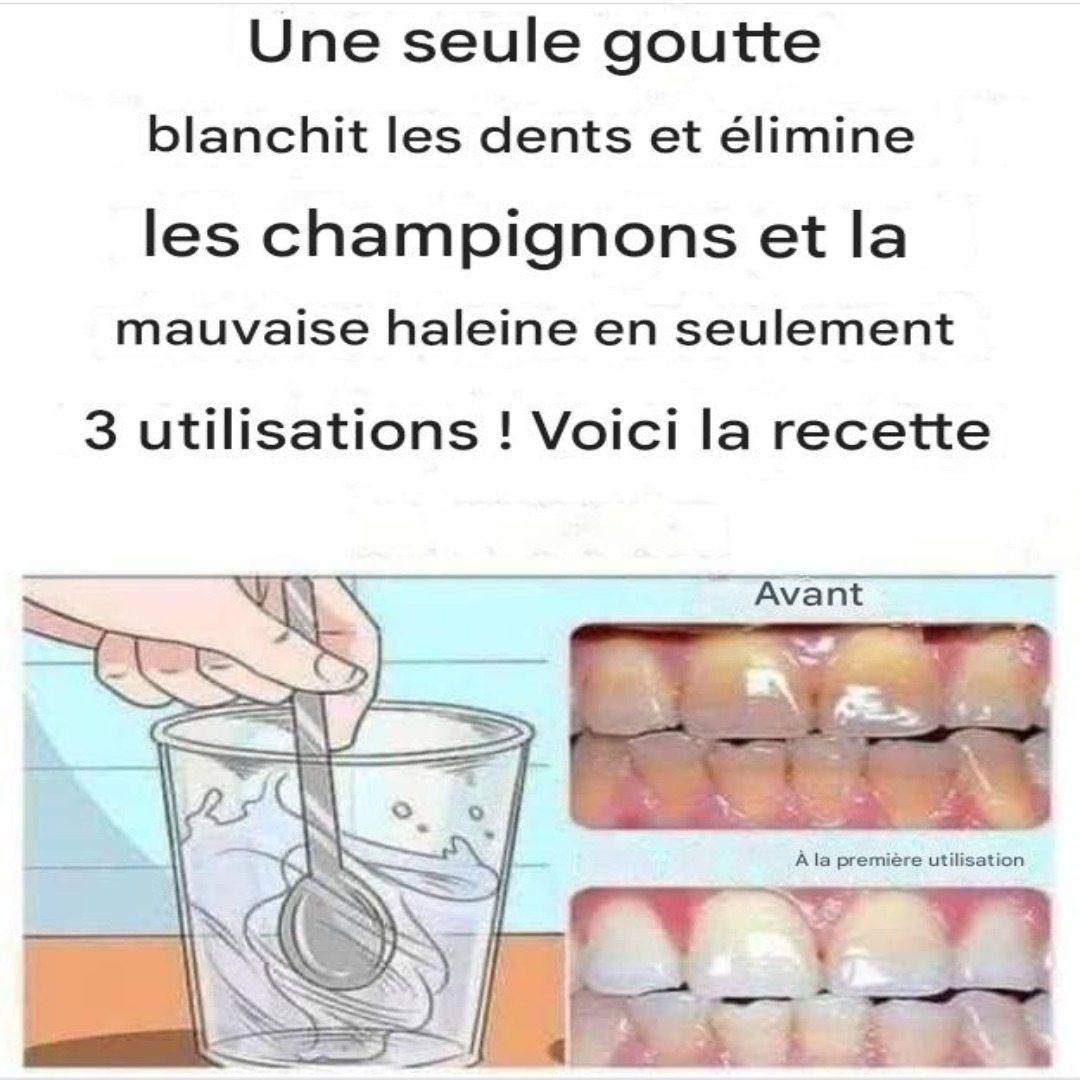 Retirez le tartre de vos dents et blanchissez-les avec cette recette simple