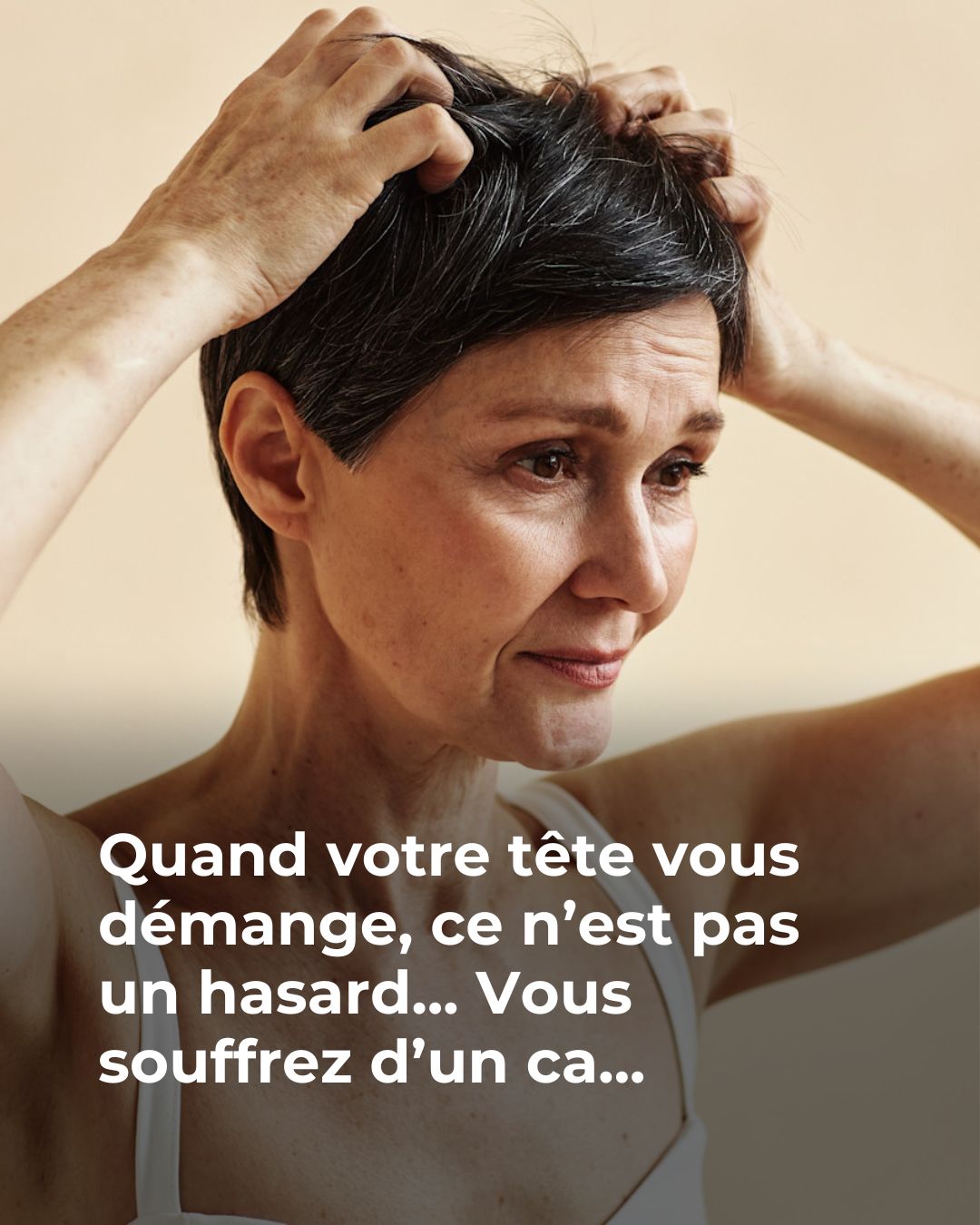 Démangeaisons du cuir chevelu : quelles sont les causes possibles ? Les réponses d’une dermatologue