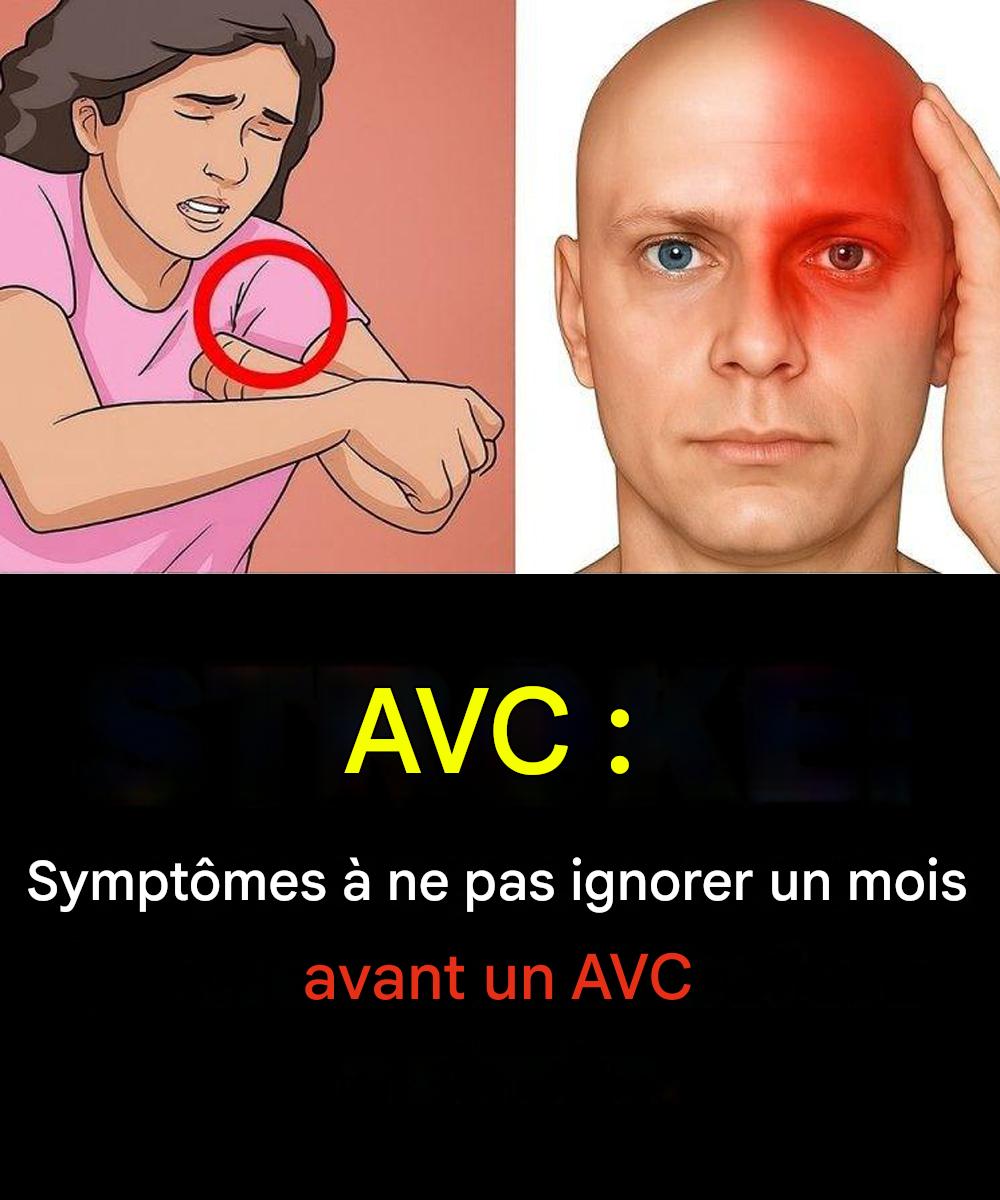 UN MOIS AVANT UN AVC, VOTRE CORPS PEUT ENVOYER CES SIGNES D’ALERTE — ET ILS PEUVENT ÊTRE DIFFÉRENTS POUR LES HOMMES ET LES FEMMES