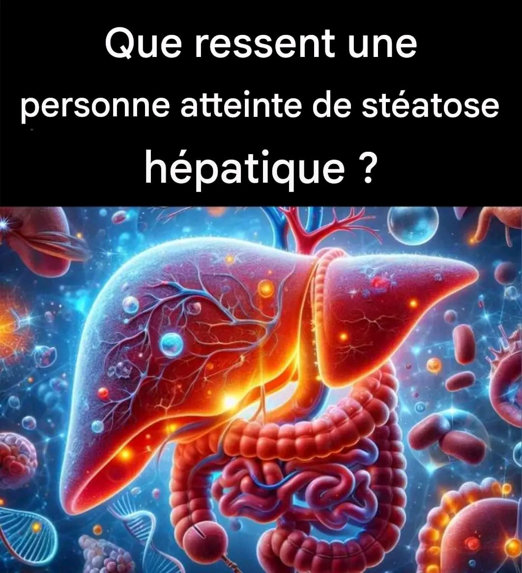 Symptômes ou signes indiquant que vous devez nettoyer votre foie
