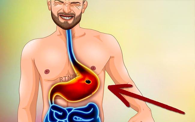 4 aliments pour soigner les ulcères gastriques (à consommer chaque jour)