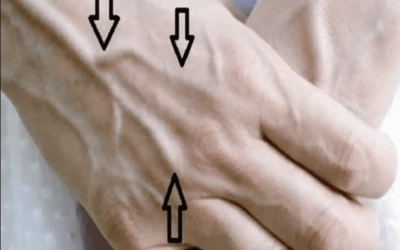 Veines visibles : quelles significations ?