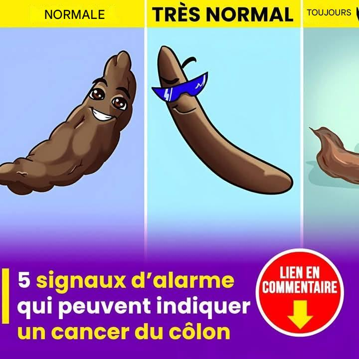 5 signes pouvant indiquer la présence d’un cancer du côlon