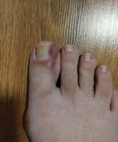 Des signes sur vos PIEDS qui indiquent que vous êtes… Voir plus