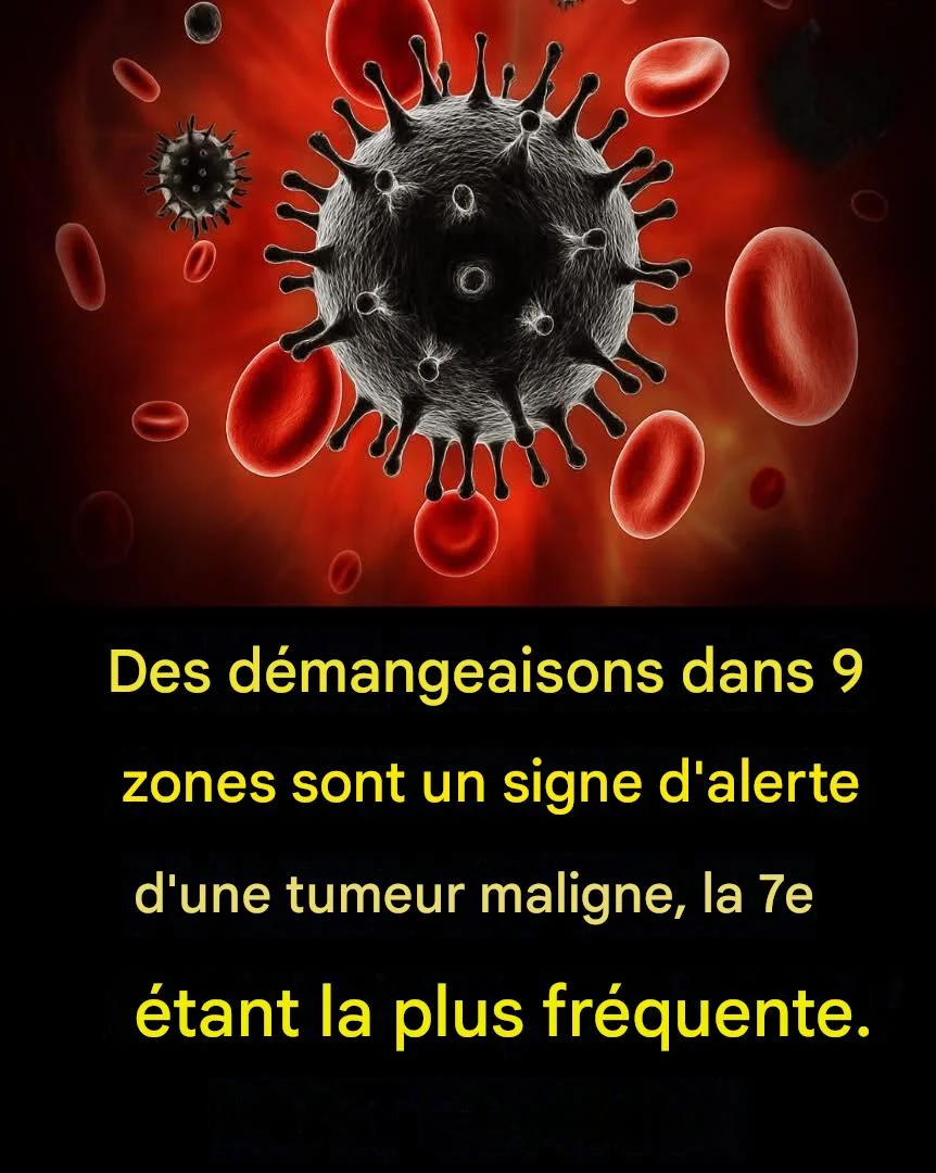 Démangeaisons dans 9 zones : un signe avant-coureur de tumeurs malignes, la zone n° 7 étant la plus fréquente.