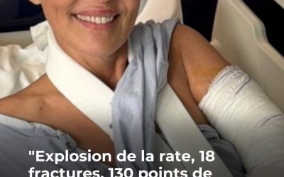 “J’ai fait une chute en allant à la gym” : Cristina Cordula donne de ses nouvelles après s’être cassé le coude juste avant de partir en vacances