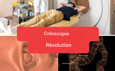 Nouvelle méthode : la coloscopie ne sera plus un examen invasif. (1/2)
