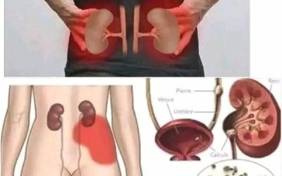 Voici les 6 aliments qui nettoient vos reins !!