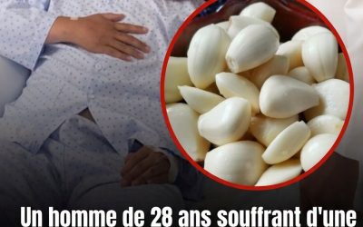 Il a mangé de l’ail chaque jour pendant 5 mois — ce qui est arrivé à ses reins a stupéfié les médecins 😳
