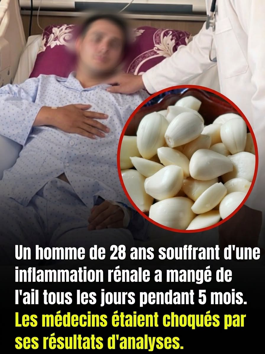 Il a mangé de l’ail chaque jour pendant 5 mois — ce qui est arrivé à ses reins a stupéfié les médecins 😳