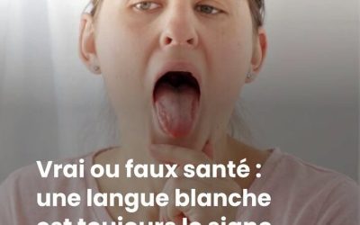 Langue blanche : quelles sont les causes et quand faut-il s’inquiéter ?