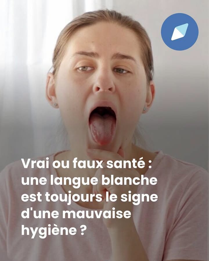 Langue blanche : quelles sont les causes et quand faut-il s’inquiéter ?