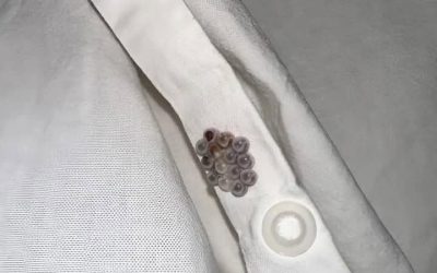 J’ai trouvé ces petites billes dans mon lit et j’ai failli avoir une crise cardiaque : je vais vous dire ce que c’était.