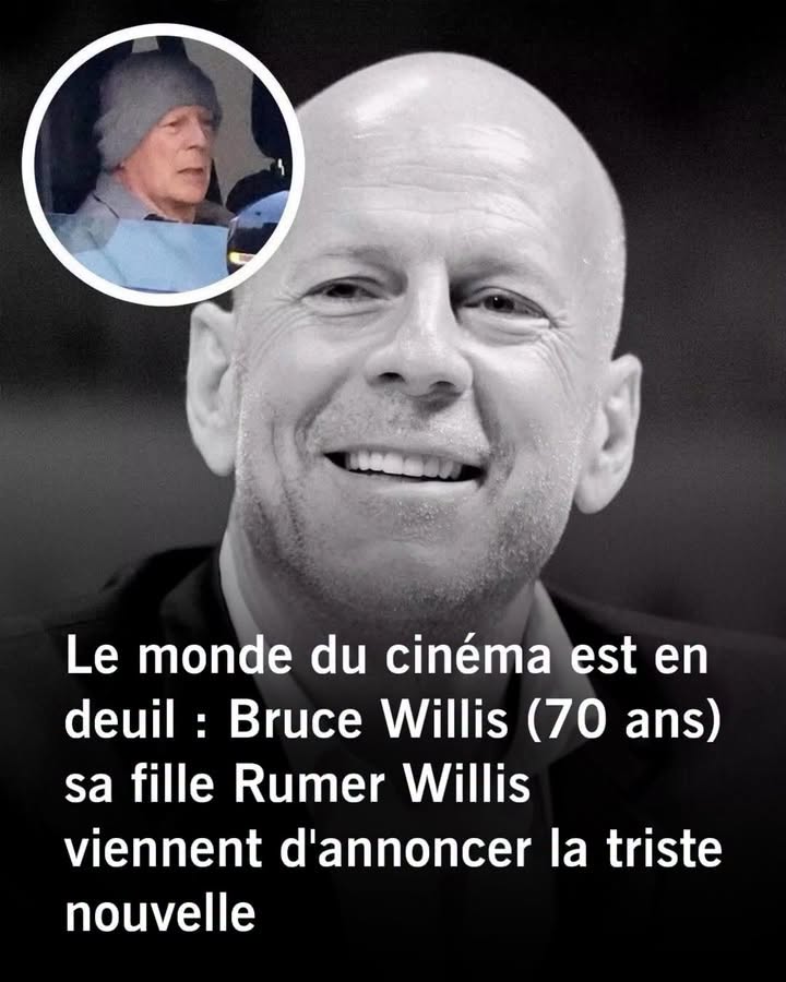 Bruce Willis, malade : cet aspect de la maladie qui brise le cœur de sa famille